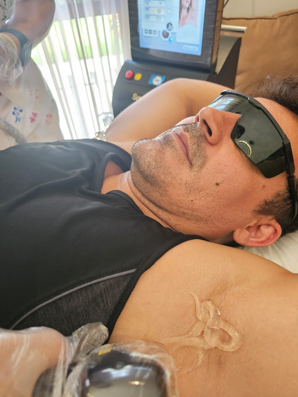 Depilação Masculina Fabia Laser